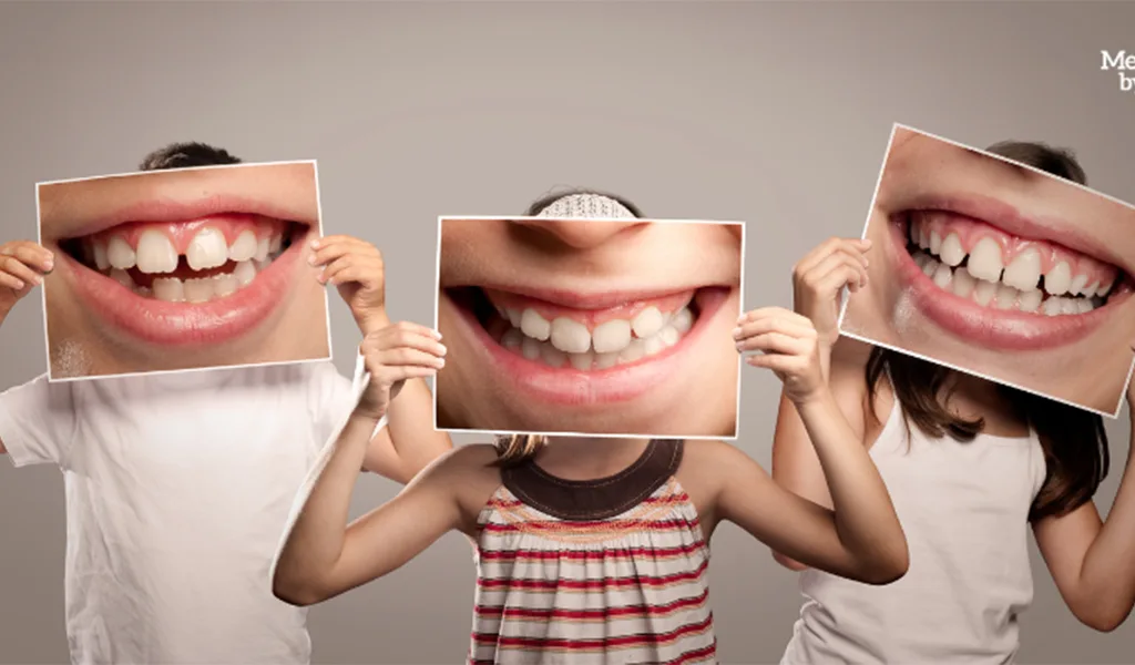 Smiling children holding close-ups of smiles. Children need fluoride to safeguard their teeth from cavities.